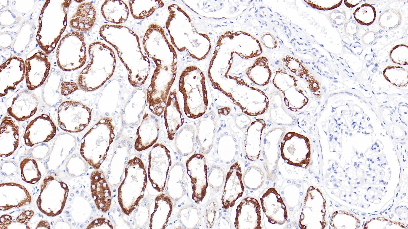 腎AMACR(CMA158)染色