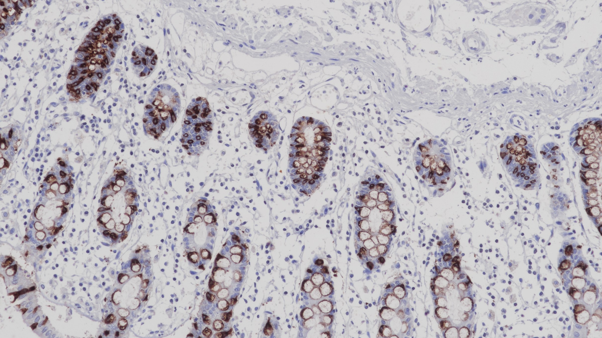 結(jié)腸MUC2(CCP58)染色