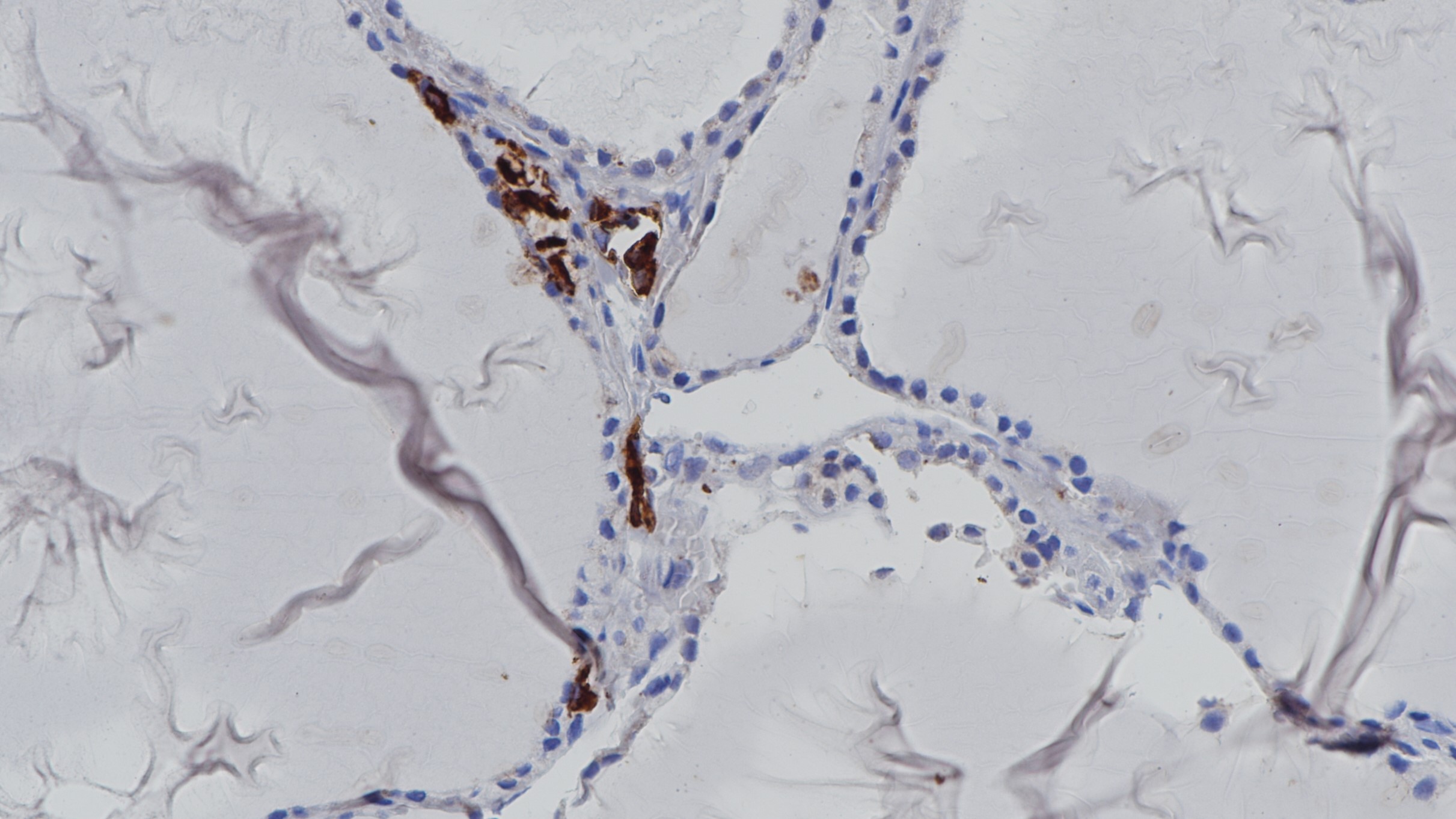 甲狀腺Calcitonin(BP6128)染色