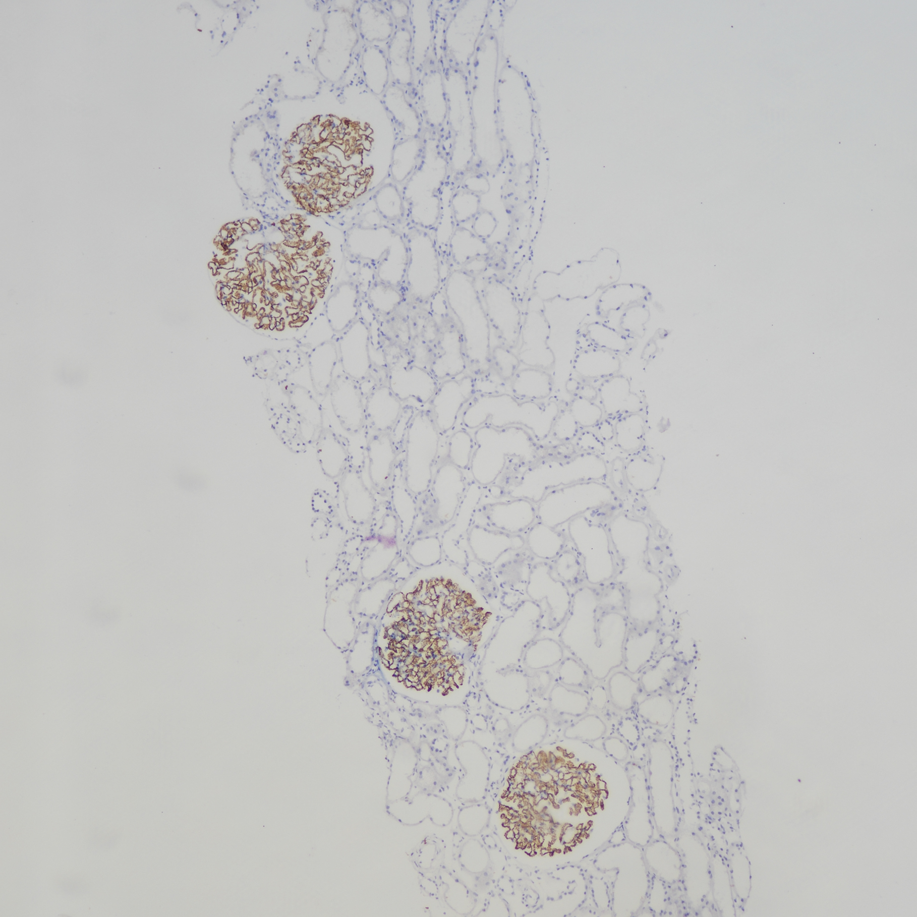 腎穿組織PLA2R(BP6284)染色